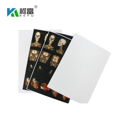 Китай Blue White Base Medical X Ray Film 35x43CM 10x12 Inch X Ray Dry Film For Fuji Printer продается