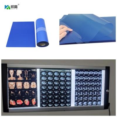 China 210microns Inkjet Medical X Ray Film For CT DR MRI  And 3D CT MRI Image Output 14x17 Te koop