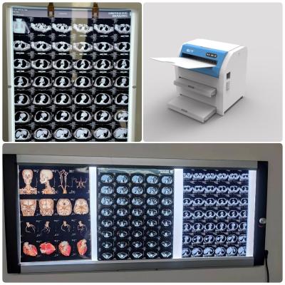 Cina 11x14 14x17 pellicola di Fuji secca medica con densità di trasmissione massima ≥ 3,0 D in vendita