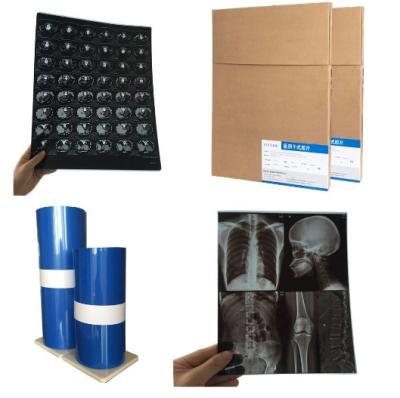 China X Ray Film Thermal Medical Dry Imaging Film For CT/Cr/Dr en venta