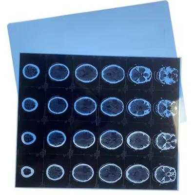 China Dry Medical Film for Inkjet Printer Blue Base Medical X-ray Film for sale