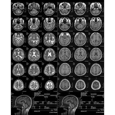 China Película médica de rayos X de uso único ajustada automáticamente a la densidad en venta