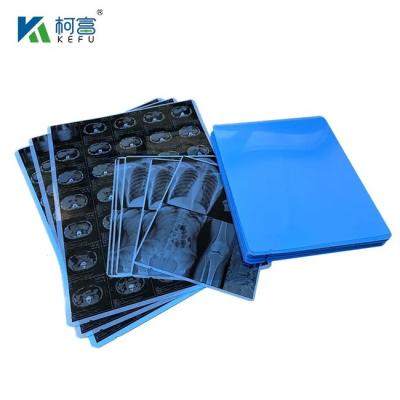 China Medical X-ray Film Green Sensitive X Ray Films Blue Sensitive X-ray Films for sale