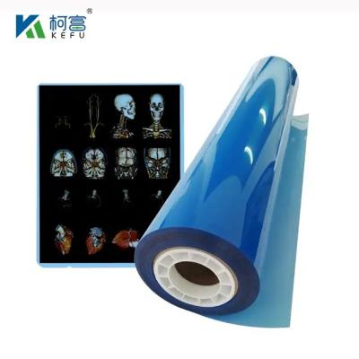 China Película de rayos X médica Película de inyección de tinta para impresora de inyección de tinta Película de rayos X blanca azul en venta