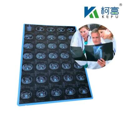 China 125 micrones Semi - láser blanco transparente X - Ray PET de plástico de películas médicas diseñadas para exceder en medicina en venta