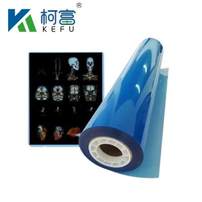 중국 Customized Size Blue White Inkjet Medical X Ray Film For Inkjet Printers In Sheets 판매용