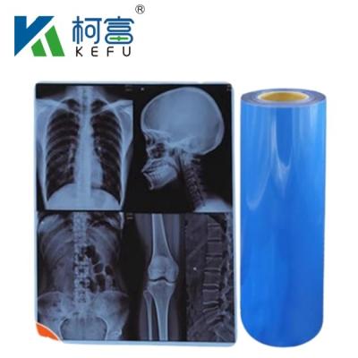 중국 Waterproof Medical X-Ray Thermal Film X Ray Blue Film For Inkjet Printers 판매용