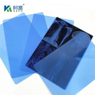 China High Resolution Blue / White Medical Film For Hospital Printing Equipment for sale