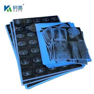 중국 Blue PET Based X Ray Thermal / Inkjet Film Medical Images For Clinic And Hospitals 판매용