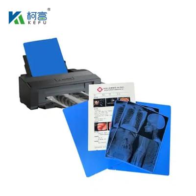 China Multiple Size Blue White Transparent Inkjet/Laser Medical Film X- Ray Film en venta