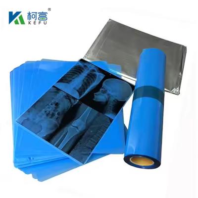 Cina High-Definition Medical X-Ray Film per immagini accurate e chiare nei mercati nazionali e internazionali. in vendita