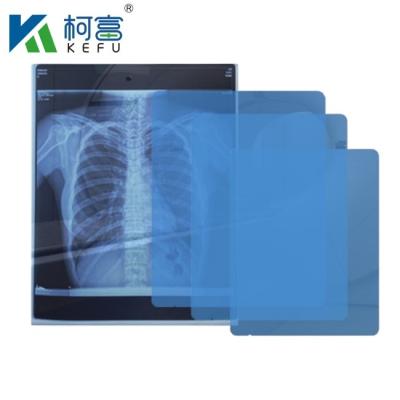 Cina Fabbrica fornitura di produzione 8x10 10x12 10x14 14x17 Inch Medicale Dihl Film asciutto Laser Xray Film per clinica e ospedali in vendita