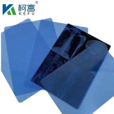 China Impresión de película azul de inyección de tinta de rayos X de 8'*10' de hoja PET de inyección de tinta de película azul de película médica de rayos X seca en venta