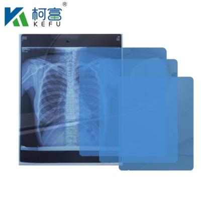 China Tamanho personalizado Filme médico de raios X Azul Filme médico sensível de raios X Filme médico a jato de tinta à venda