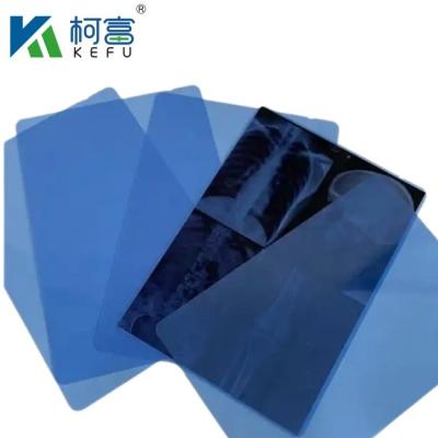 China Precio de fábrica Venta directa Película médica de rayos X Impresión térmica láser de rayos X Películas semitransparentes de rayos X Tinta inyectable Película médica azul en venta