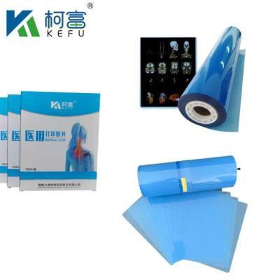 China Película láser de alto contraste de inyección de tinta de película médica azul PET Película de rayos X para impresoras de inyección de tinta y láser en venta