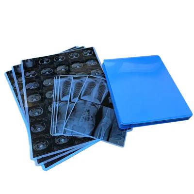 China Medical Blue X - Ray Film For Laser Printing   Medical Hosiptal Consuables for sale