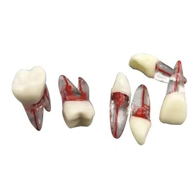 China Dental Teaching Practice Dental Teeth Root Canal Teeth Endo Tooth Training Block Model For Student Training for sale