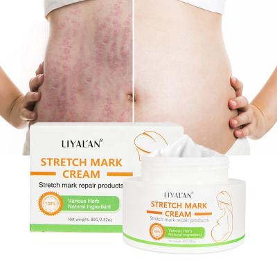 China Skin Revitalizer Skin Revitalizer Private Label Vegan Body Skin Care Best Breast Repair Scar Removal Stretch Mark Cream for sale