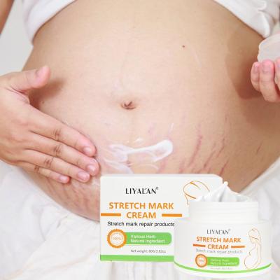 China Skin Revitalizer Skin Revitalizer 2021Hot Selling Best Scar Treatment Stretchmark Skin Body Care Stretch Marks Removal Cream for sale