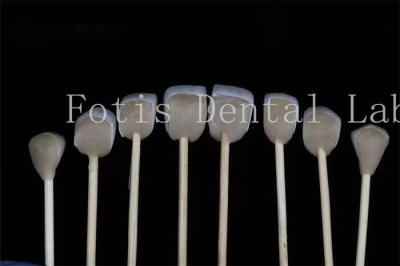 Cina Veneer di laboratorio dentale laminato personalizzabili Compatibilità con vari preparati dentali in vendita