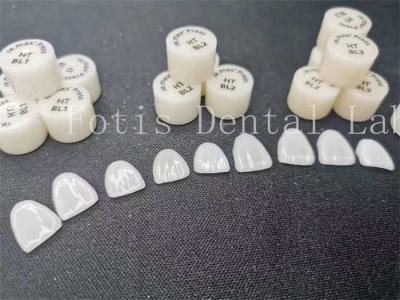 China Customization Dental Lab Laminate Veneers with High Stain Resistance and Strength for sale