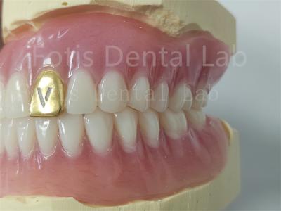 China Dentes de acrílico con dentadura completa personalizable Resistente a olores Confort Fit en venta