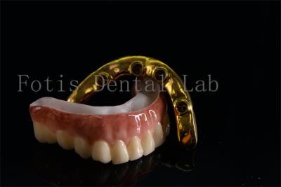 China Affordable All On Six Dental Implants Effective Treatment Easy To Clean for sale