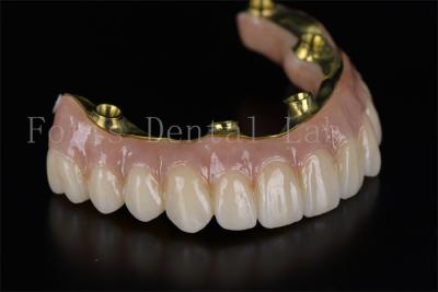 China Reconstrução da Boca Completa Sistema de Implantes Dentários All On 4 All On 6 à venda