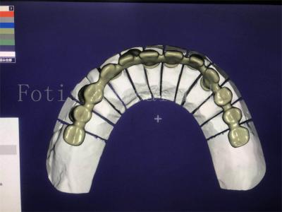 Cina Servizio di progettazione dentale affidabile ed efficace superiore e competitivo in vendita