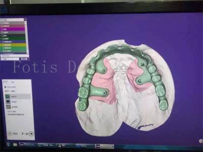 Cina Studio di progettazione di protesi dentarie per il restauro dei denti, esperto per la vostra soddisfazione in vendita