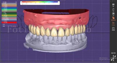 China Dienst für die Gestaltung von Zahnprothesen mit Planung von Prothesen und Oralimplantaten zu verkaufen