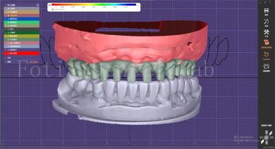 China OEM Modelos de Boca Fabricante Servicio de Diseño Dental Con Constructor de Planos Dentarios en venta