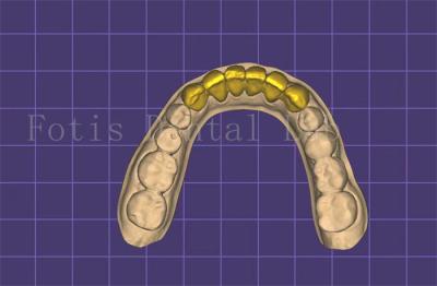 China Fabricante de modelo de boca dental personalizable autoclavable aprobado por la FDA en venta