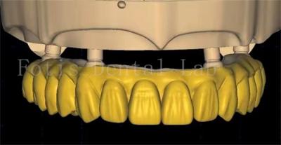 China OEM-Dentalkronen-Design verwendet fortschrittliche Scanning- und 3D-Drucktechnologie zu verkaufen