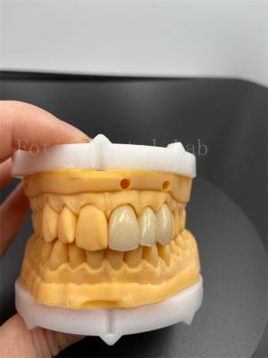 Cina Corone digitali ad adattazione di precisione Impianto dentale con modalità di trasmissione di posta elettronica compatibile in vendita