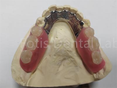 China OEM Dentadura parcial removível flexível fácil de limpar / manter à venda