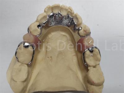 China Prótese dentária parcial ajustável Prótese dentária confortável para dentes ausentes à venda