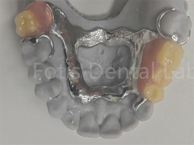 China FDA Dentadura parcial extraíble fácil de limpiar compatible con dientes naturales en venta