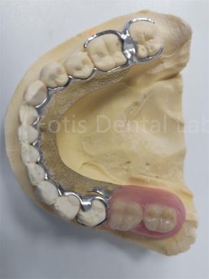 China Reemplazar los dientes faltantes Dentadura parcial extraíble Prótese dental Diseño flexible en venta