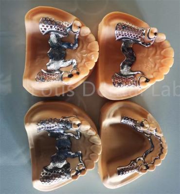 China Dentadura parcial flexible extraíble con estabilidad duradera y confort ajustable en venta