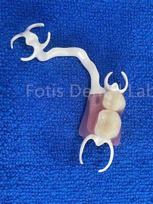 China Dentadura parcial removível para substituição de dentes estáveis à venda