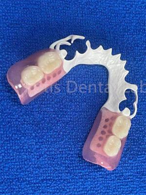 China Prótesis dental ajustable flexible estable cómoda Dentadura parcial inmediata en venta