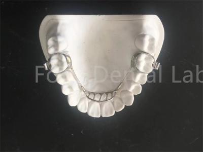 China Retener de expansión personalizable Retener de expansión palatal Mantener de expansión fácil mantenimiento en venta