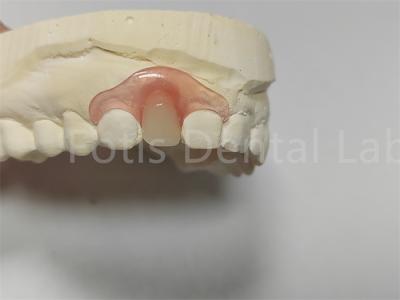 China Flexible Pink / Transparent Valspar Dental Partials Easy Adjustment for sale