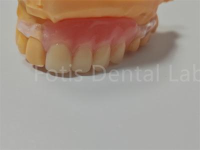 China FDA/ISO Certification TCS Valplast Flexible Dentures Easy To Clean Adjust for sale