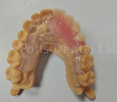 Cina Dispositivo dentale TCS parziale con Valplast flessibile in vendita