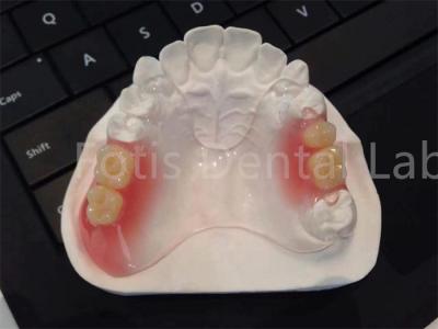 Cina Flessibile TCS Valplast Apparecchi dentali Confortevole Design durevole in vendita