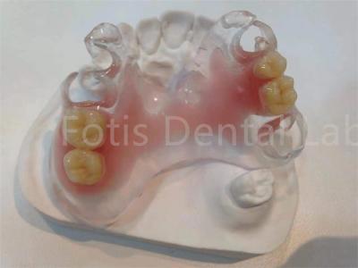 China Hypoallergenic Stain Resistant TCS Valplast Dental Prosthetics For Long Lasting Comfort for sale