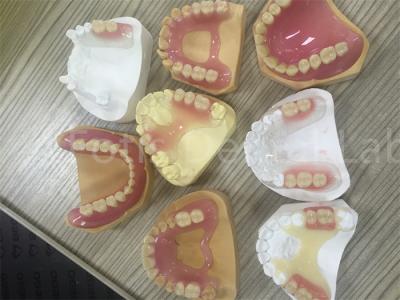 Chine Denture partielle amovible facile à ajuster à vendre